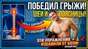 Как мне удалось побороть грыжу в шее и пояснице без операции личный опыт и упражнения