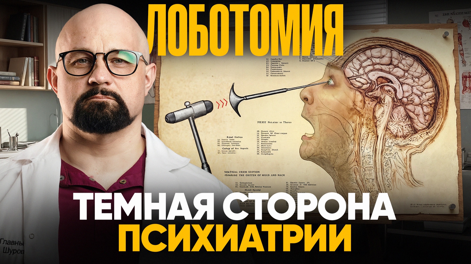 ЛОБОТОМИЯ. ЧТО СКРЫВАЛИ ПСИХИАТРЫ? Что чувствовал человек после Лоботомии?
