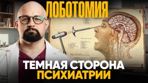 ЛОБОТОМИЯ. ЧТО СКРЫВАЛИ ПСИХИАТРЫ? Что чувствовал человек после Лоботомии?