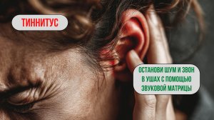 🎧 Матрица против тиннитуса (звона и шума в ушах) | Терапия тиннитуса 🧠🔊✨