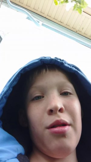 99