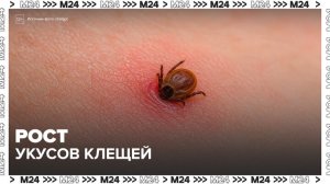 Число пострадавших от укусов клещей в России выросло до 18 тыс - Москва 24