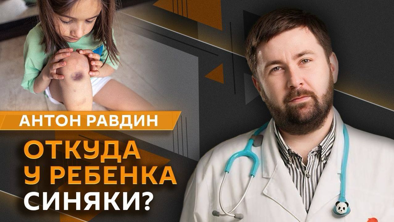 Антон Равдин. Как выявить авитаминоз, какие синяки опасны и можно ли детям шашлык?
