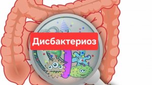 Дисбактериоз. Как улучшить флору кишечника.
