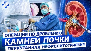 Перкутанная нефролитотрипсия. Минимально инвазивная операция по разрушению камней почки