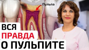 Лечение пульпита за 1 визит – миф или реальность?