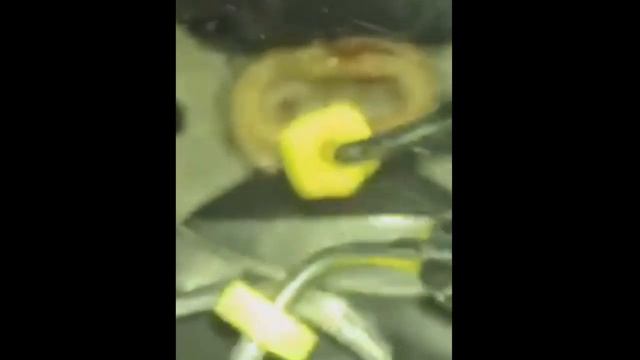 Трехканальный премоляр 15