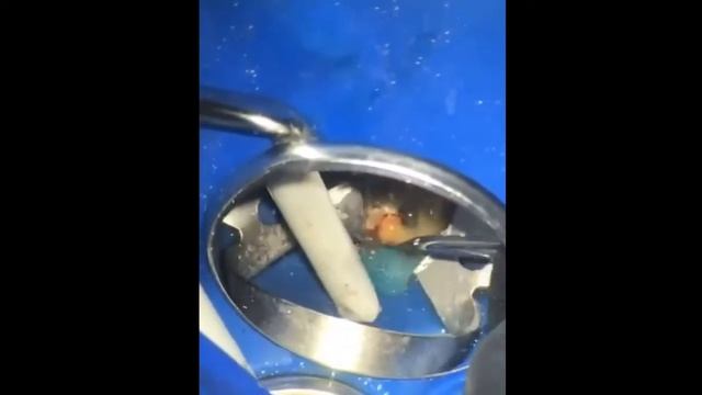 Селективное перелечивание