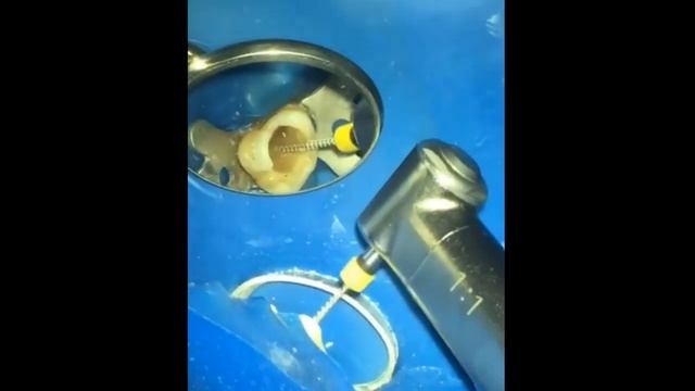 Перелечивание пасты