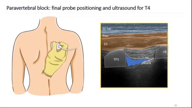 L.17.01 - Breast Surgery