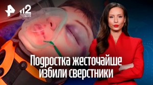 Подростка жестоко избили сверстники в Подмосковье