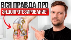 Что происходит со СВЯЗКАМИ во время ТОТАЛЬНОГО ЭНДОПРОТЕЗИРОВАНИЯ коленного СУСТАВА?