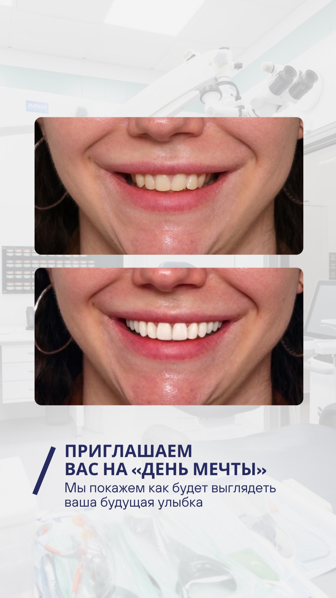 Хотите увидеть какой станет ваша улыбка до начала лечения?