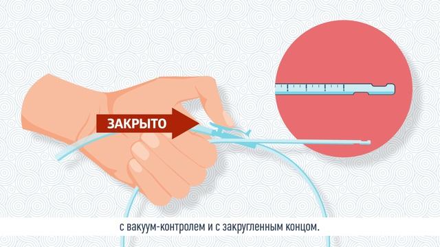 О санации дыхательных путей