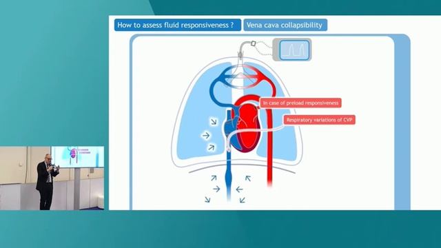 ASSESSING PRELOAD RESPONSIVENESS WITH THE VENTILATOR