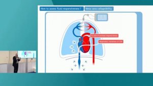 ASSESSING PRELOAD RESPONSIVENESS WITH THE VENTILATOR
