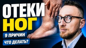 ОТЕКИ НОГ: 9 основных причин