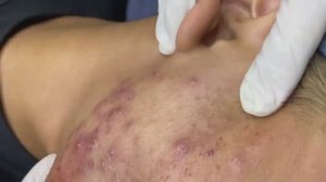 120 • Acne collection • АСМР • Relax Spa