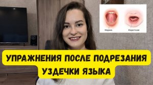 Упражнения после подрезания уздечки языка