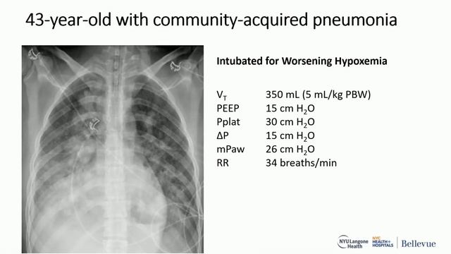 Ventilation during ECMO for ARDS ISICEM 45
