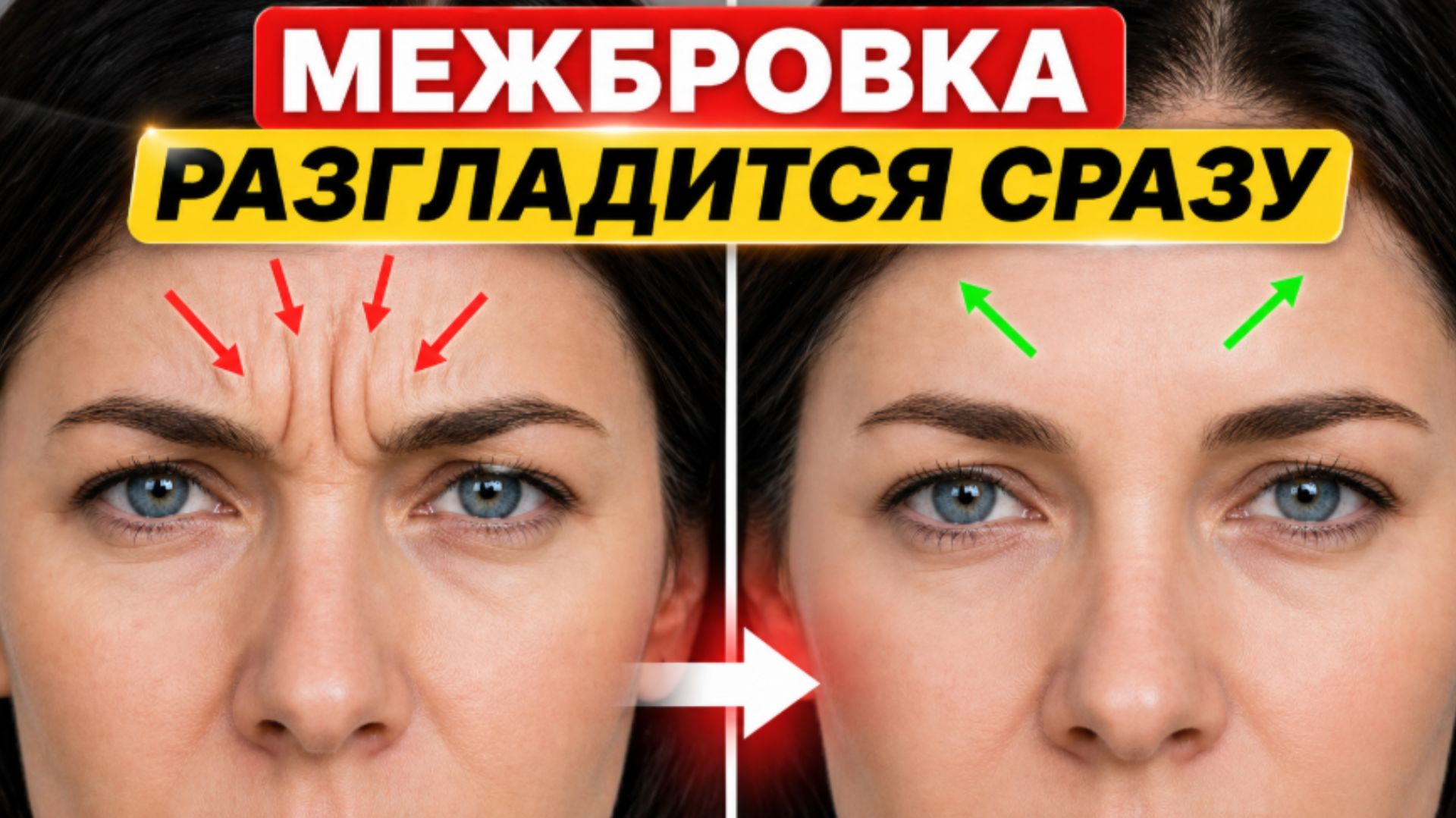 РЕЗУЛЬТАТ вас удивит: МОРЩИНЫ между бровями ИСЧЕЗАЮТ от этой техники
