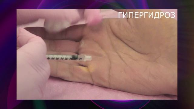 Косметологические процедуры к лету. Клиника «Медэст»