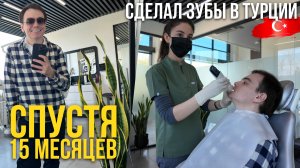 Стоит ли делать зубы в Турции? Мой честный чекап спустя 15 месяцев: гарантия, щель и реальная цена