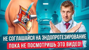 Вся правда об эндопротезировании тазобедренного сустава. Варианты эндопротезирования.