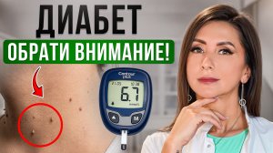 Так начинается ДИАБЕТ! Первые симптомы, на которые вы не обращаете внимание