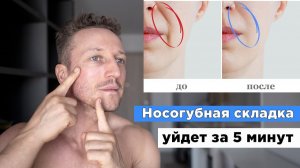 Носогубная складка уйдет за 5 минут! Как убрать НОСОГУБНЫЕ СКЛАДКИ