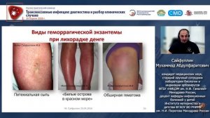 Завозные арбовирусные лихорадки на клинических примерах