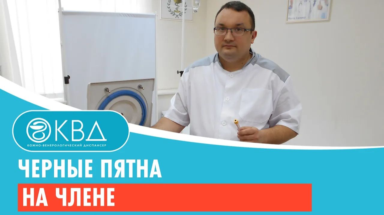 Черные пятна на члене. Клинический случай №66 смотреть онлайн