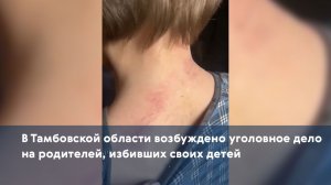 В Тамбовской области возбуждено уголовное дело на родителей, избивших своих детей