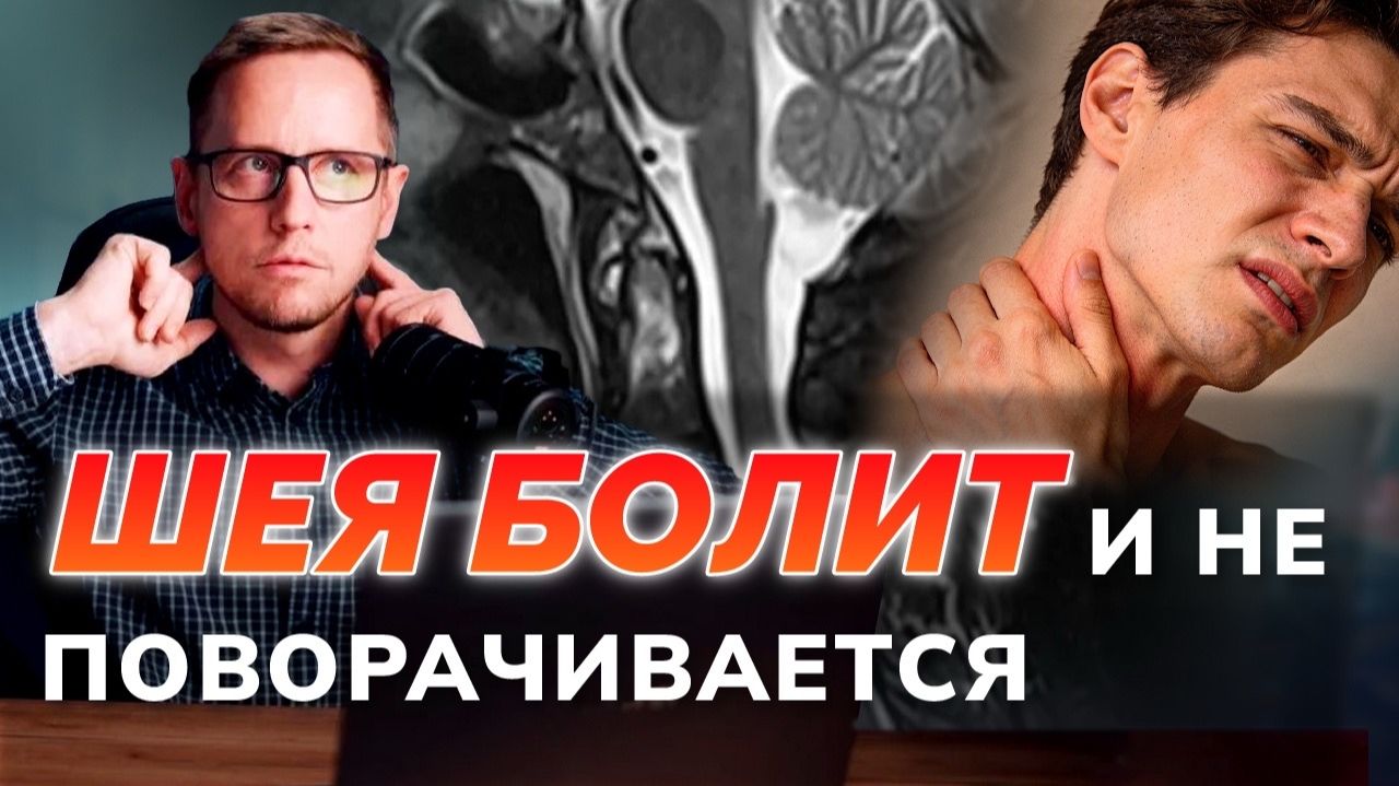 Два года мучений! БОЛЬ В ШЕЕ лечили неправильно. Разбираю ошибки, МРТ и ставлю правильный диагноз