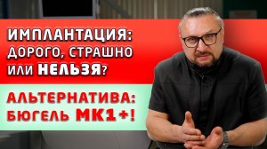 Съемный протез МК1 плюс (бюгель без бюгеля): показываем, как выглядит и устанавливается!
