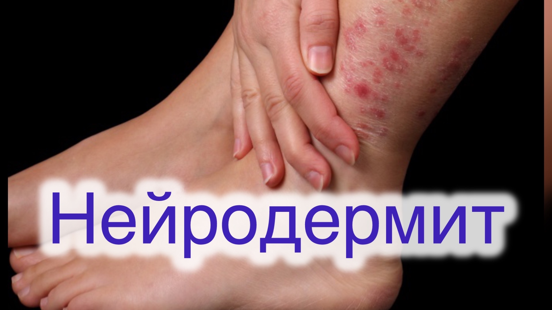 Свидетельства Сауна Нуга-Бест