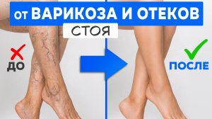 Сосудистая гимнастика от ОТЕКОВ и ВАРИКОЗА | 9 минут для лёгких ног
