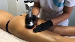 Горячий_Вакуумный_RF_массаж_в_COSMO_BEAUTY
