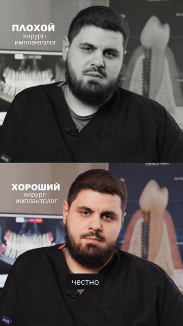 Плохой/Хороший хирург-имплантолог