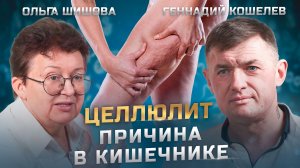 ЦЕЛЛЮЛИТ - что это такое на самом деле | Ольга Шишова и Геннадий Кошелев