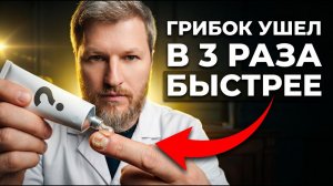 ГРИБОК НОГТЕЙ: как вылечить дома раз и навсегда?