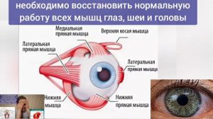 Компрессия глазной артерии и зрительного нерва ухудшает зрение. Упражнения