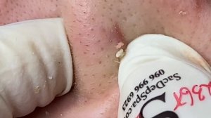 128 • Acne collection • АСМР • Relax Spa