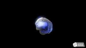 Neuralink создали робота для установки мозговых имплантов, oн использует 8 камер и специальные...
