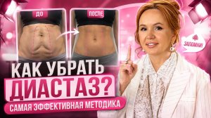 Как убрать диастаз? Самая эффективная методика БЕЗ ОПЕРАЦИЙ