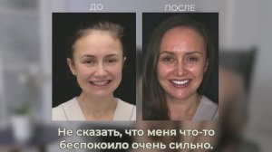 NKclinic - отзывы пациентов. Проблемы с ВНЧС. Исправление прикуса, имплантация, установка 28 виниров
