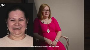 NKclinic - отзывы пациентов. За один прием установлено 14 имплантатов, выполнен синус-лифтинг
