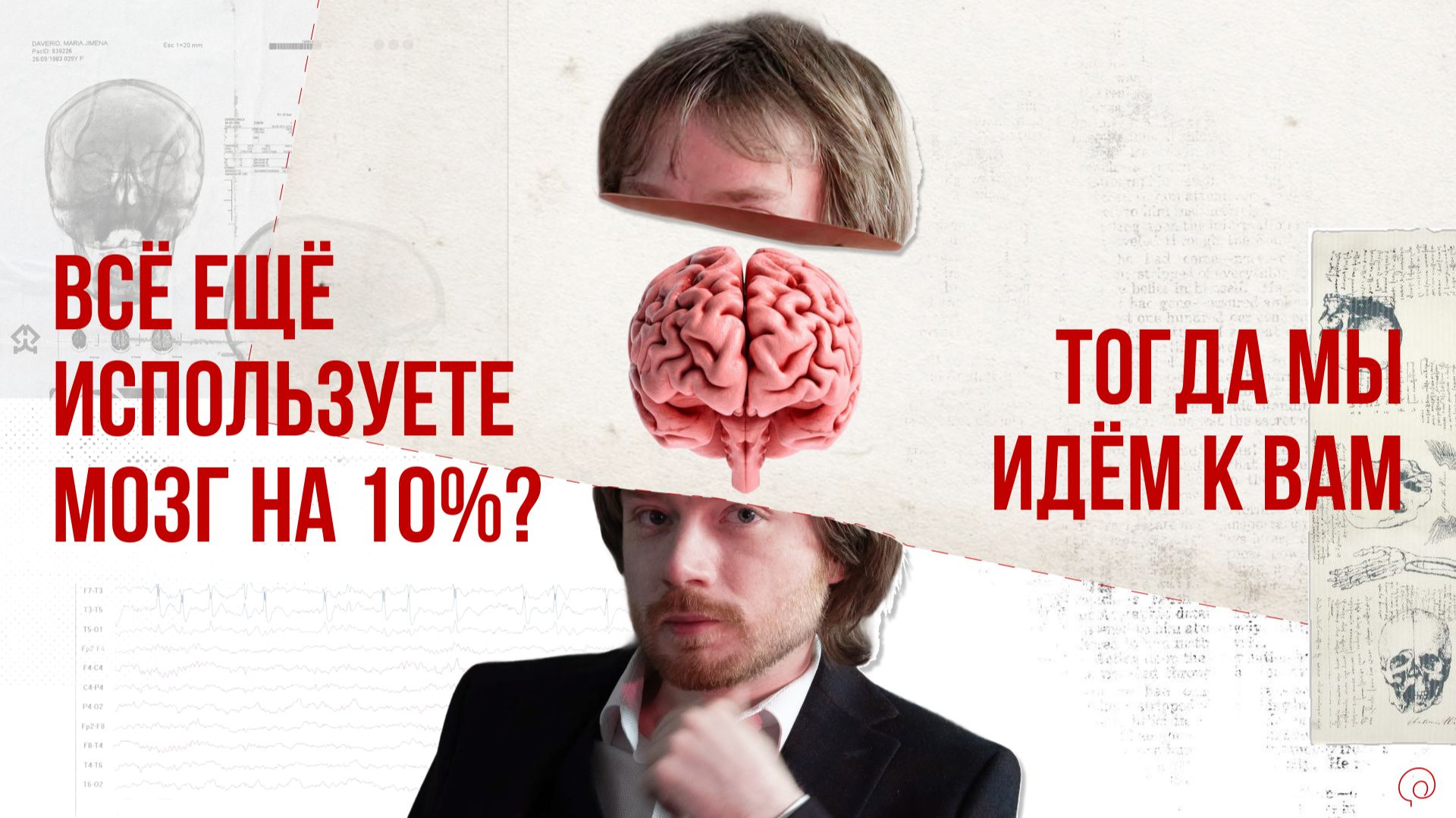 Вы используете МОЗГ на 10?