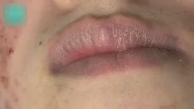 Механическая чистка лица у косметолога смотреть онлайн