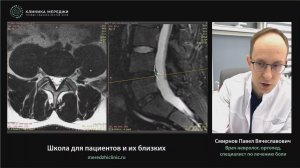 Боль в пояснице при разрыве фиброзного кольца диска у молодого человека. Разбор МРТ